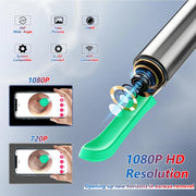 Smart HD Visual Ear Cleaner